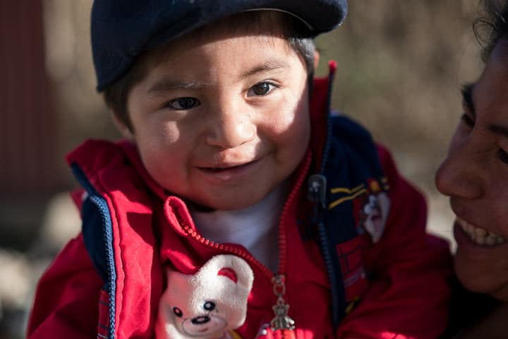 Carlos had his cleft lip repaired by a Samaritan's Purse medical team.
