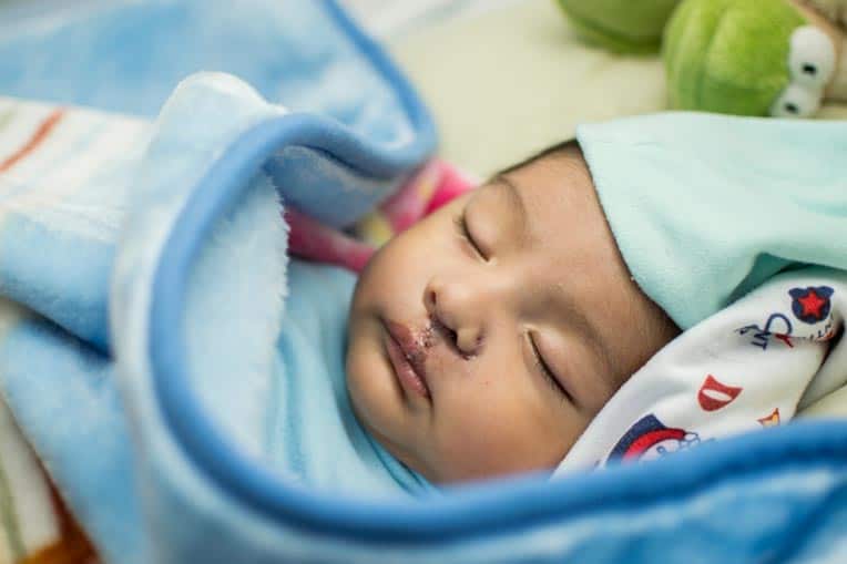 Both 3-month-old Eynar and his father, Sergio, were born with cleft lips. Sergio is grateful that Eynar was able to have surgery so early in life to spare him the bullying that Sergio had endured as a child.