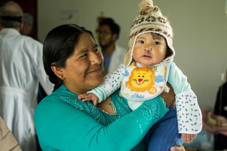Jhoel's mother Zulema comforts her son after the surgery to repair his cleft lip.